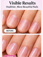 SHOPAMIRI 2-in-1 Cuticle Care Pen™ – Nail & Cuticle Care