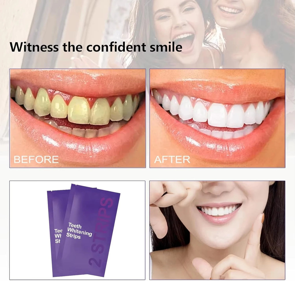 SHOPAMIRI Whitening Strips™ – At-Home Smile Care